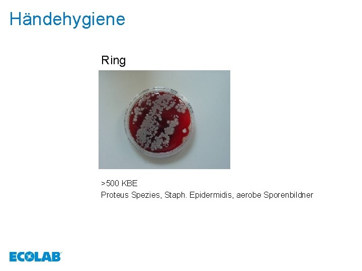 Händehygiene Ring >500 KBE Proteus Spezies, Staph. Epidermidis, aerobe Sporenbildner 