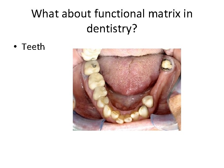 What about functional matrix in dentistry? • Teeth 