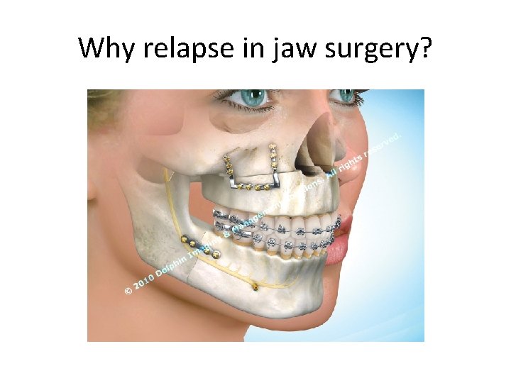 Why relapse in jaw surgery? 