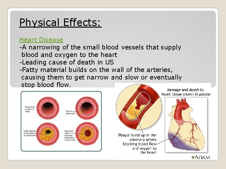 Physical Effects: Heart Disease -A narrowing of the small blood vessels that supply blood