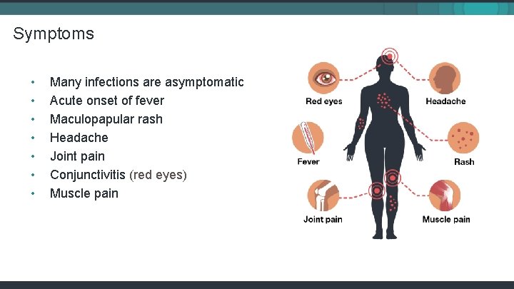 Symptoms • • Many infections are asymptomatic Acute onset of fever Maculopapular rash Headache