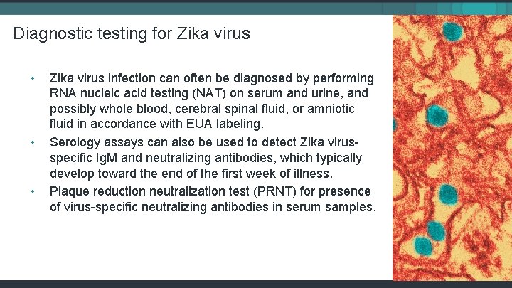 Diagnostic testing for Zika virus • • • Zika virus infection can often be