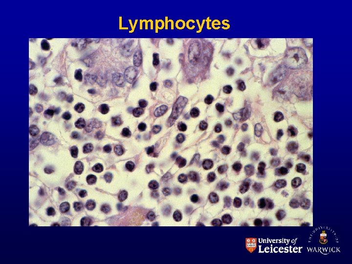 Lymphocytes 