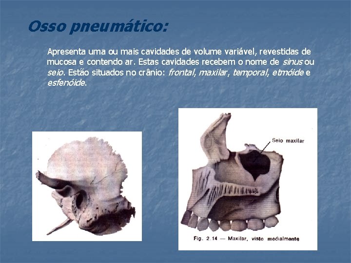 Osso pneumático: Apresenta uma ou mais cavidades de volume variável, revestidas de mucosa e