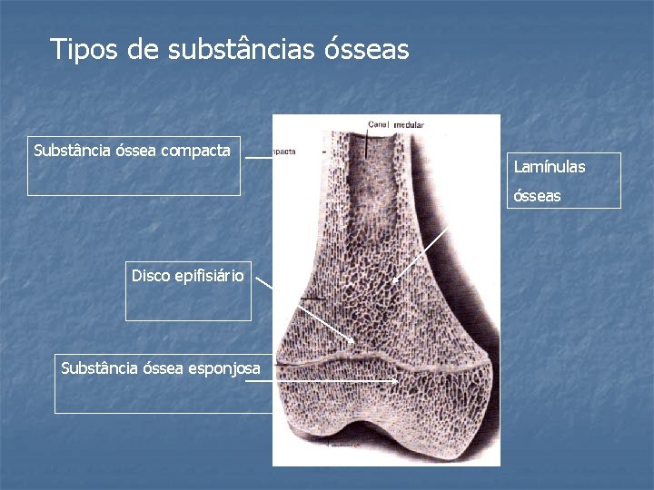 Tipos de substâncias ósseas Substância óssea compacta Lamínulas ósseas Disco epifisiário Substância óssea esponjosa