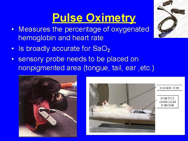 Pulse Oximetry • Measures the percentage of oxygenated hemoglobin and heart rate • Is Pulse Oximetry • Measures the percentage of oxygenated hemoglobin and heart rate • Is