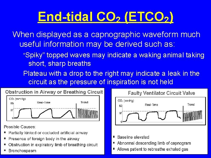 End-tidal CO 2 (ETCO 2) When displayed as a capnographic waveform much useful information End-tidal CO 2 (ETCO 2) When displayed as a capnographic waveform much useful information
