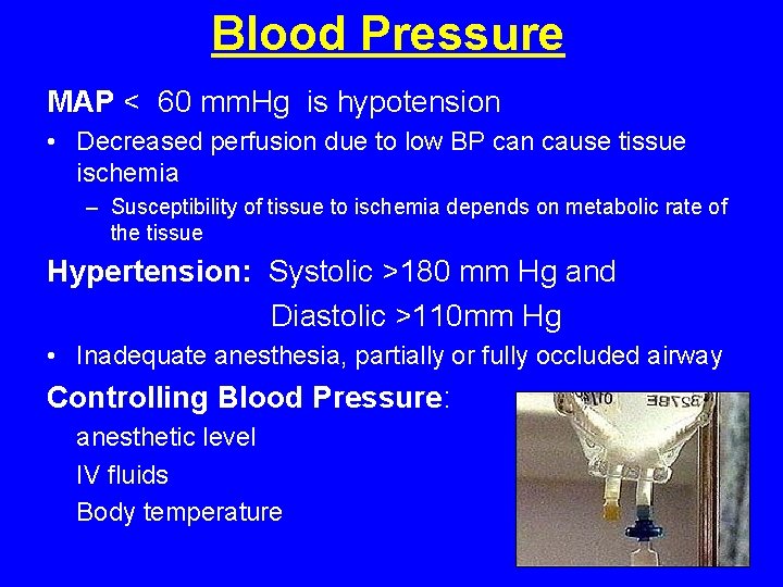 Blood Pressure MAP < 60 mm. Hg is hypotension • Decreased perfusion due to Blood Pressure MAP < 60 mm. Hg is hypotension • Decreased perfusion due to
