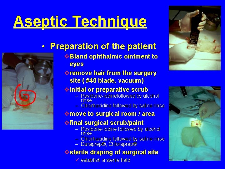Aseptic Technique • Preparation of the patient v. Bland ophthalmic ointment to eyes vremove Aseptic Technique • Preparation of the patient v. Bland ophthalmic ointment to eyes vremove