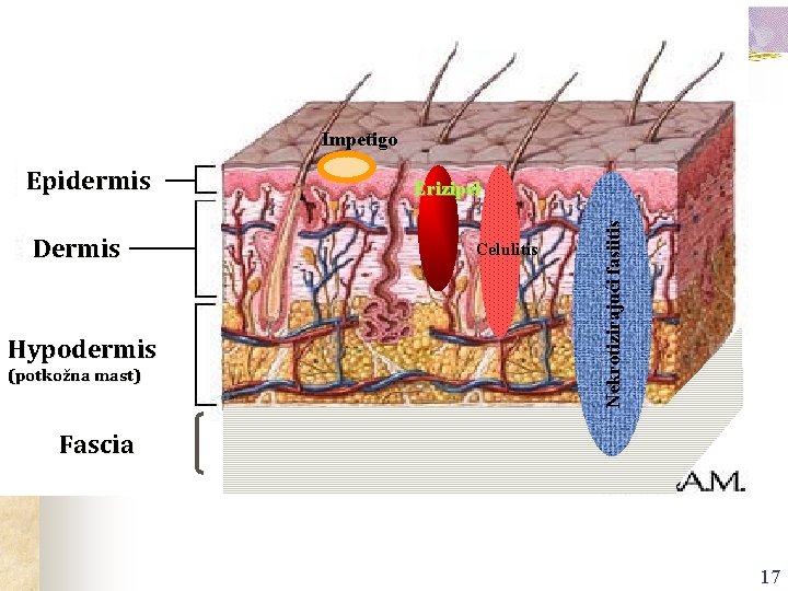 Impetigo Dermis Hypodermis (potkožna mast) Erizipel Celulitis Nekrotizirajući fasiitis Epidermis Fascia 17 