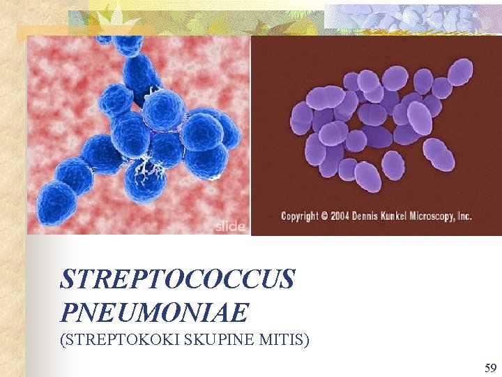 STREPTOCOCCUS PNEUMONIAE (STREPTOKOKI SKUPINE MITIS) 59 