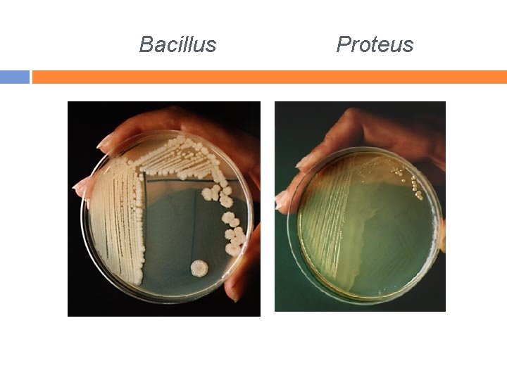 Bacillus Proteus 