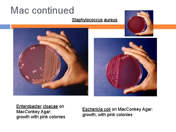 Mac continued Staphylococcus aureus Enterobacter cloacae on Mac. Conkey Agar: growth with pink colonies