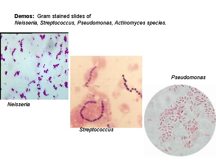 Demos: Gram stained slides of Neisseria, Streptococcus, Pseudomonas, Actinomyces species. Pseudomonas Neisseria Streptococcus 