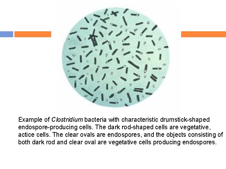 Example of Clostridium bacteria with characteristic drumstick-shaped endospore-producing cells. The dark rod-shaped cells are