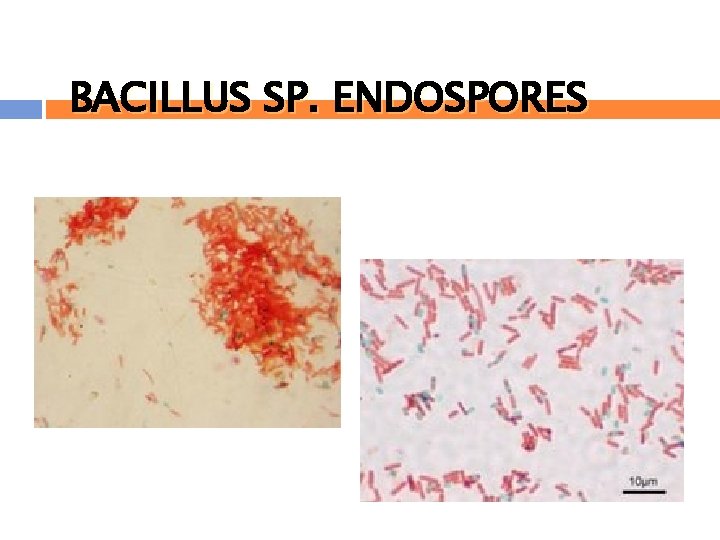 BACILLUS SP. ENDOSPORES 
