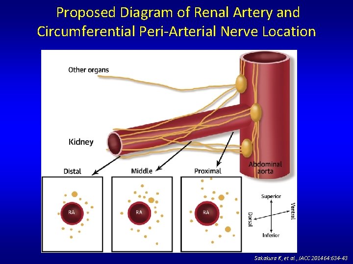 Proposed Diagram of Renal Artery and Circumferential Peri-Arterial Nerve Location Sakakura K, et al.
