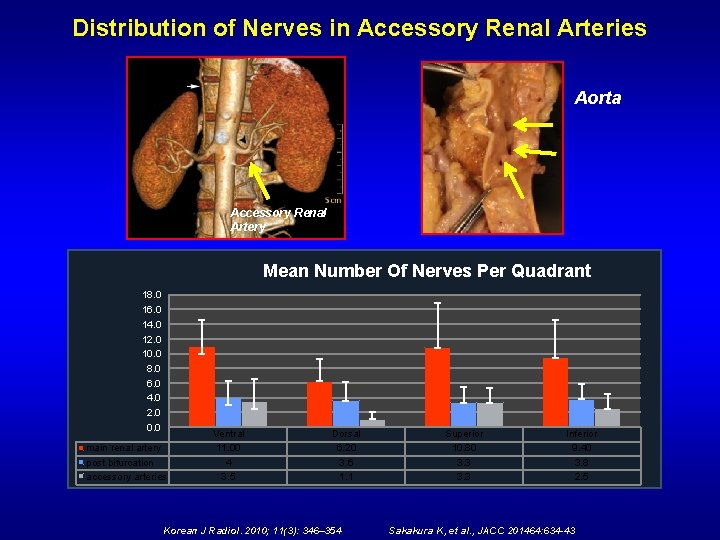 Distribution of Nerves in Accessory Renal Arteries Aorta Accessory Renal Artery Mean. Number. Of