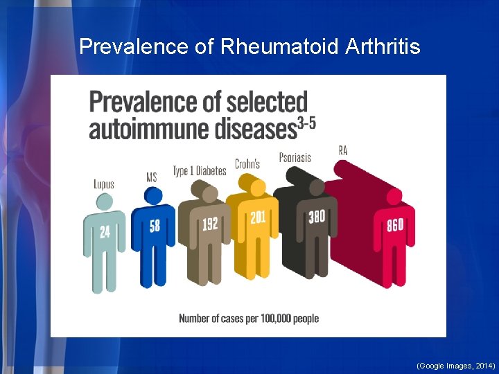 Prevalence of Rheumatoid Arthritis (Google Images, 2014) 