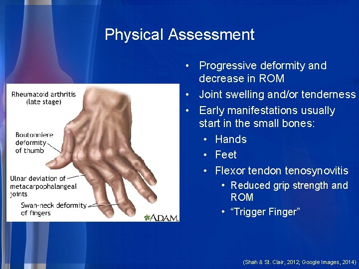 Physical Assessment • Progressive deformity and decrease in ROM • Joint swelling and/or tenderness