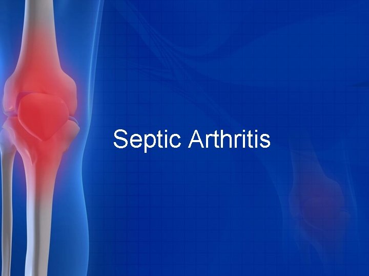 Septic Arthritis 