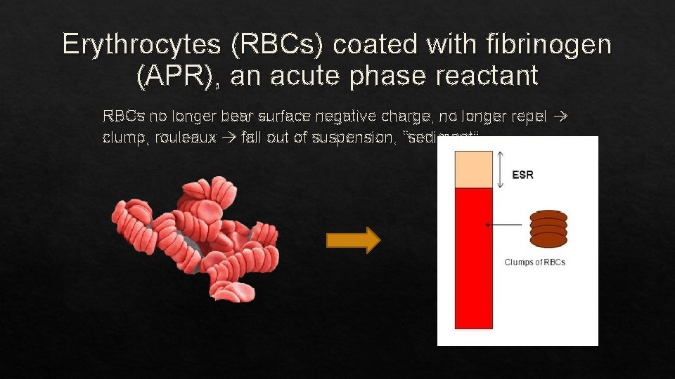 Erythrocytes (RBCs) coated with fibrinogen (APR), an acute phase reactant RBCs no longer bear