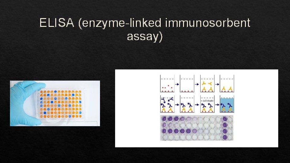 ELISA (enzyme-linked immunosorbent assay) 