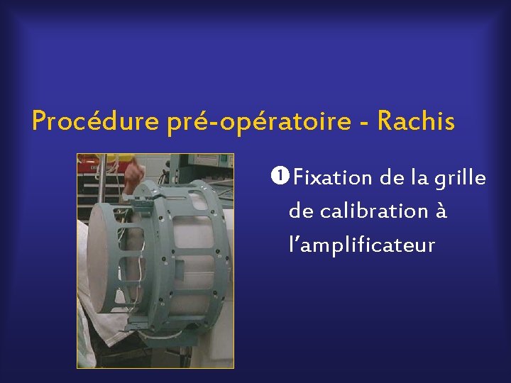 Procédure pré-opératoire - Rachis Fixation de la grille de calibration à l’amplificateur 