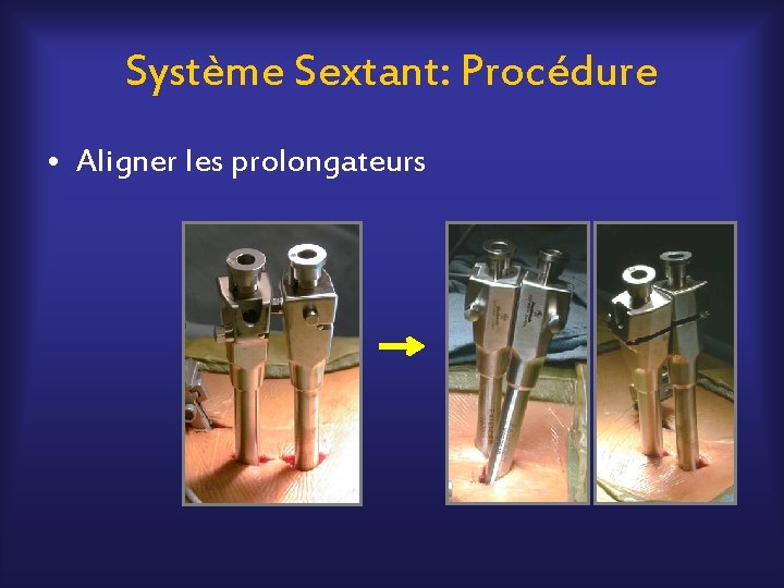 Système Sextant: Procédure • Aligner les prolongateurs 