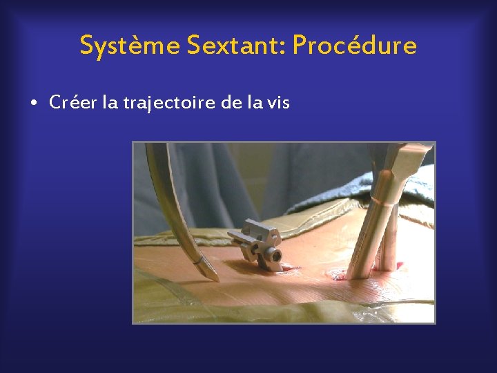 Système Sextant: Procédure • Créer la trajectoire de la vis 