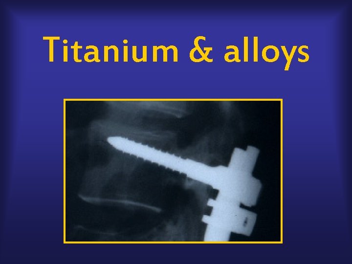 Titanium & alloys 