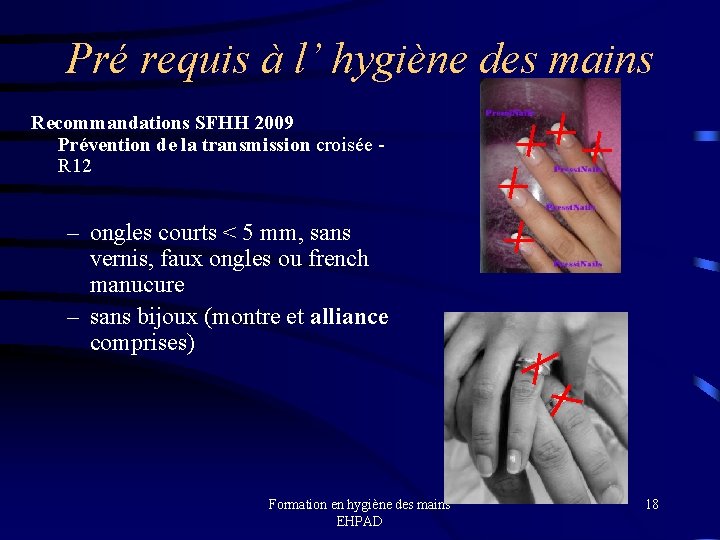 Pré requis à l’ hygiène des mains Recommandations SFHH 2009 Prévention de la transmission