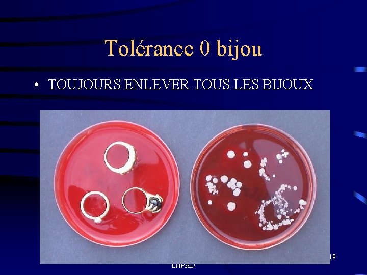 Tolérance 0 bijou • TOUJOURS ENLEVER TOUS LES BIJOUX Formation en hygiène des mains