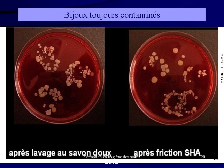 Bijoux toujours contaminés Formation en hygiène des mains EHPAD 20 