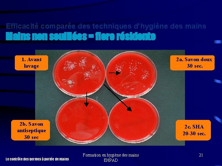 Efficacité comparée des techniques d’hygiène des mains Mains non souillées = flore résidente 1.