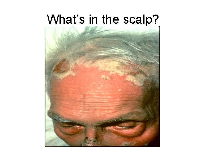 What’s in the scalp? 