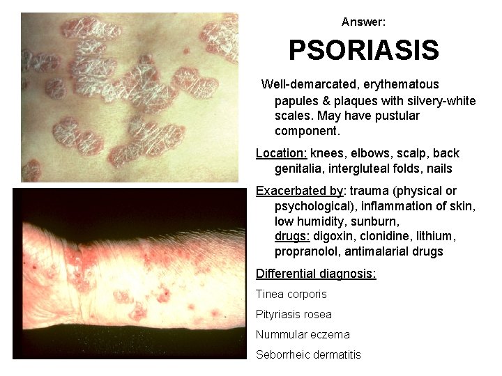 Answer: PSORIASIS Well-demarcated, erythematous papules & plaques with silvery-white scales. May have pustular component.