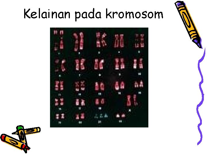Kelainan pada kromosom 