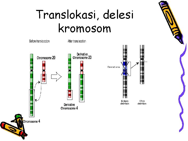 Translokasi, delesi kromosom 