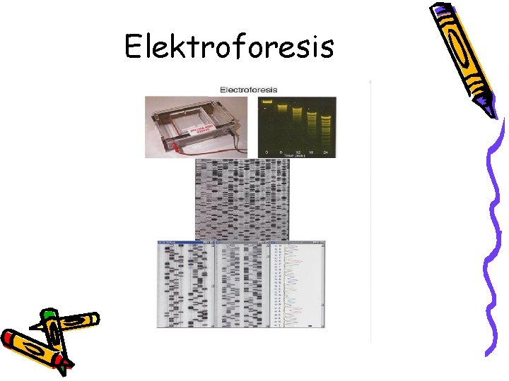 Elektroforesis 