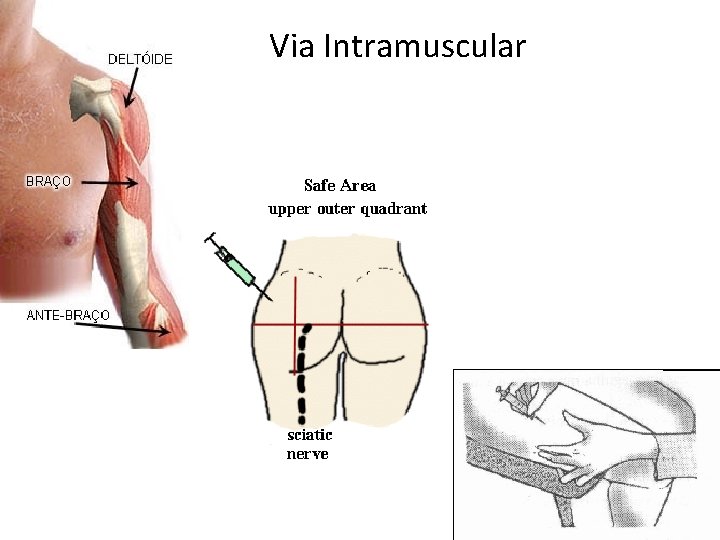 Via Intramuscular Via Intramuscular