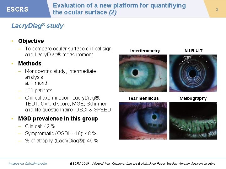ESCRS Evaluation of a new platform for quantifiying the ocular surface (2) Lacry. Diag®