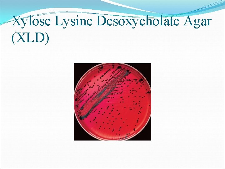 Xylose Lysine Desoxycholate Agar (XLD) 