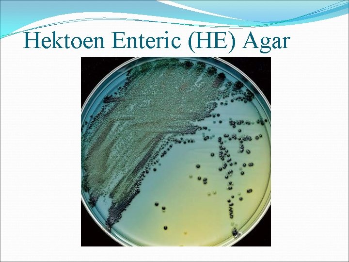 Hektoen Enteric (HE) Agar 