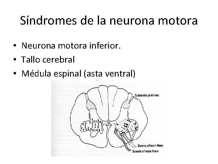 Síndromes de la neurona motora • Neurona motora inferior. • Tallo cerebral • Médula