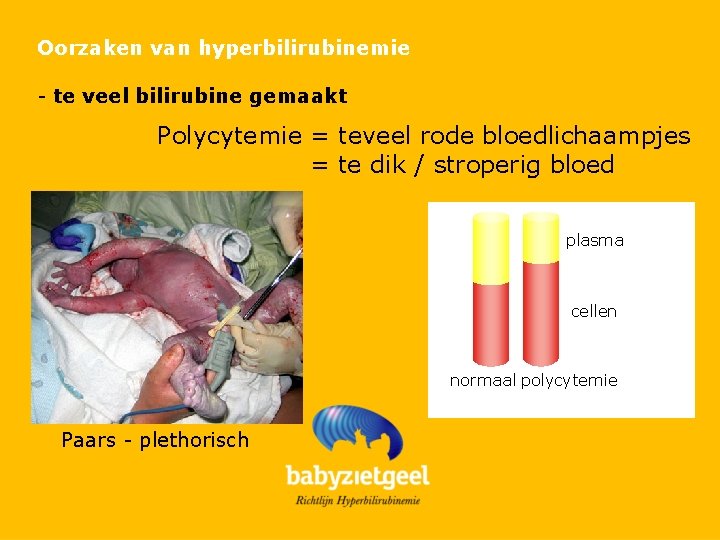 Oorzaken van hyperbilirubinemie - te veel bilirubine gemaakt Polycytemie = teveel rode bloedlichaampjes =