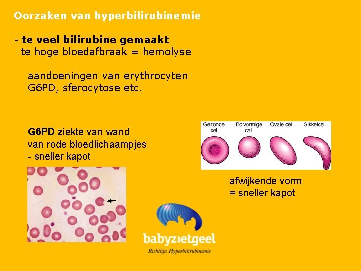 Oorzaken van hyperbilirubinemie - te veel bilirubine gemaakt te hoge bloedafbraak = hemolyse aandoeningen