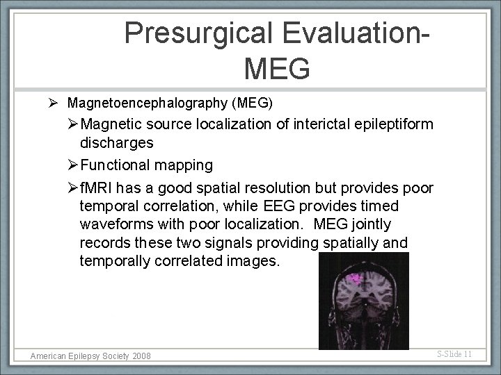 Presurgical Evaluation. MEG Ø Magnetoencephalography (MEG) ØMagnetic source localization of interictal epileptiform discharges ØFunctional