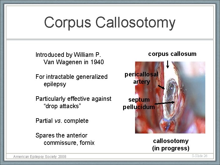 Corpus Callosotomy Introduced by William P. Van Wagenen in 1940 For intractable generalized epilepsy