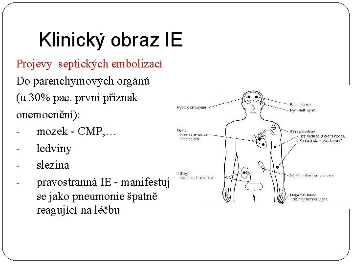 Klinický obraz IE Projevy septických embolizací Do parenchymových orgánů (u 30% pac. první příznak